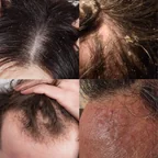 Método Cabelo Limpo de Verdade — Tricologia Natural