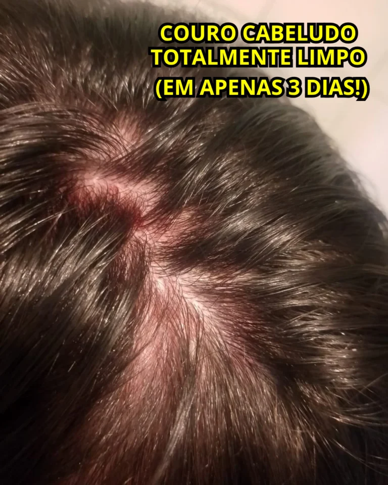 Gabriel Depois do Tratamento